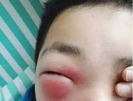 男孩玩游戏手机发烫怎么办_男孩玩游戏手机发烫怎么办_男孩玩游戏手机发烫怎么办