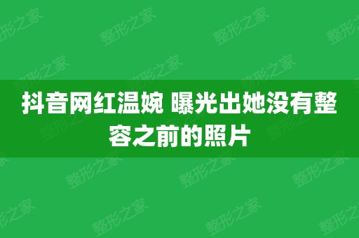 抖音圈作品发朋友圈怎么发_抖音作品发到朋友圈_抖音作品为什么发不了朋友圈