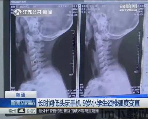 选择游戏对决 (图1)